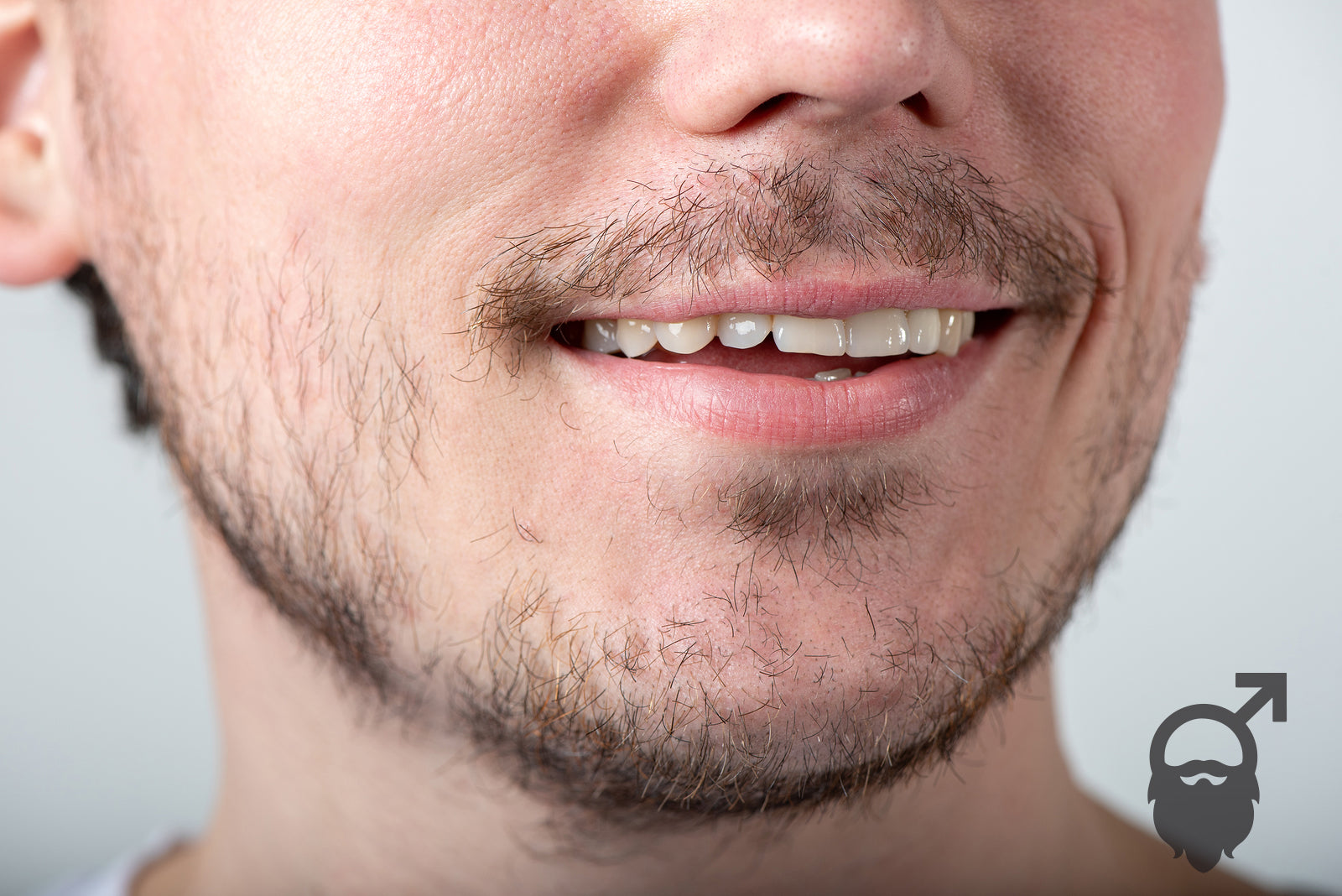 Patchy Beard and Bald Spots: Top Causes & What You Can Do